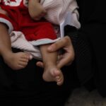 La guerra en Yemen continúa sin que se vislumbren avances hacia la paz mientras que un niño muere cada diez minutos por causas prevenibles; esto según insistieron este lunes varios altos responsables de Naciones Unidas ante el Consejo de Seguridad de la ONU.